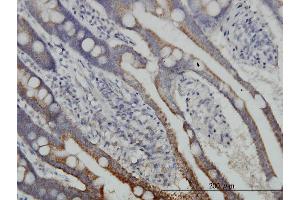 Immunoperoxidase of monoclonal antibody to DLD on formalin-fixed paraffin-embedded human small Intestine. (DLD 抗体  (AA 1-509))