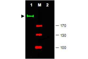 Western blot using Gli2 polyclonal antibody  shows detection of a predominant band at ~190 KDa corresponding to Gli2 (arrowhead) in mouse brain tissue lysate (Lane 1). (GLI2 抗体  (Internal Region))
