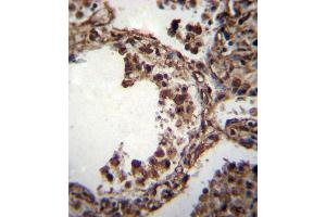 TUBA1C Antibody (C-term) (ABIN655982 and ABIN2845366) immunohistochemistry analysis in formalin fixed and paraffin embedded human lung tissue followed by peroxidase conjugation of the secondary antibody and DAB staining. (TUBA1C 抗体  (C-Term))