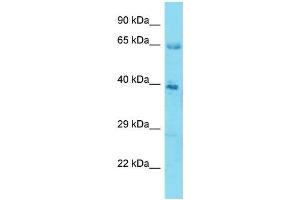 Host:  Rabbit  Target Name:  KLHL12  Sample Type:  Stomach Tumor lysates  Antibody Dilution:  1. (KLHL12 抗体  (N-Term))