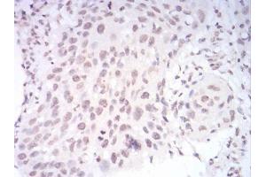 Immunohistochemistry (IHC) image for anti-Paired Box 6 (PAX6) (AA 1-122) antibody (ABIN5542664)