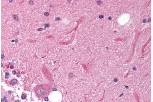 Human Brain, Cerebellum (formalin-fixed, paraffin-embedded) stained with SOX11 antibody ABIN214147 at 5 ug/ml followed by biotinylated goat anti-rabbit IgG secondary antibody ABIN481713, alkaline phosphatase-streptavidin and chromogen. (SOX11 抗体  (N-Term))