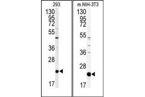 Image no. 1 for anti-Phosphatidylethanolamine Binding Protein 1 (PEBP1) (Middle Region) antibody (ABIN360564) (PEBP1 抗体  (Middle Region))