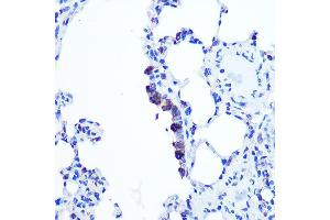 Immunohistochemistry of paraffin-embedded Rat lung using TOP1MT Rabbit pAb (ABIN7270851) at dilution of 1:100 (40x lens). (TOP1MT 抗体  (AA 470-550))