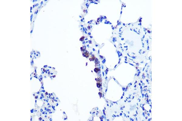 TOP1MT antibody  (AA 470-550)