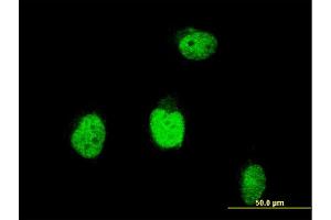 Immunofluorescence of monoclonal antibody to BLM on HeLa cell. (BLM 抗体  (AA 1196-1295))