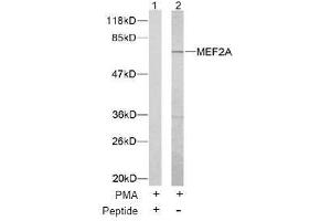 Image no. 1 for anti-Myocyte Enhancer Factor 2A (MEF2A) (Thr312) antibody (ABIN197165) (MEF2A 抗体  (Thr312))
