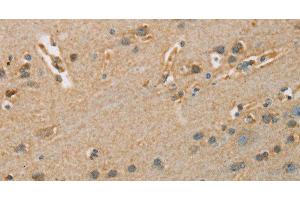 Immunohistochemistry of paraffin-embedded Human brain tissue using ARSA Polyclonal Antibody at dilution 1:50 (Arylsulfatase A 抗体)
