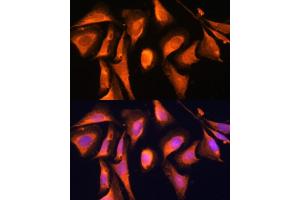 Immunofluorescence analysis of U-2 OS cells using R antibody (ABIN6128592, ABIN6146556, ABIN6146557 and ABIN6215667) at dilution of 1:100. (RAB21 抗体  (AA 1-225))