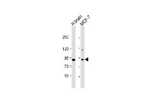 All lanes : Anti-JIP1 Antibody (C-term) at 1:1000 dilution Lane 1: human brain lysate Lane 2: MCF-7 whole cell lysate Lysates/proteins at 20 μg per lane. (MAPK8IP1 抗体  (C-Term))