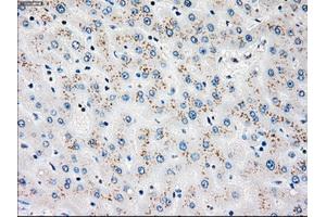 Immunohistochemical staining of paraffin-embedded liver tissue using anti-PLK1mouse monoclonal antibody. (PLK1 抗体)