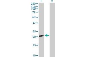 Western Blot analysis of BATF2 expression in transfected 293T cell line by BATF2 MaxPab polyclonal antibody. (BATF2 抗体  (AA 1-189))
