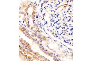 Antibody staining USP2 in human kidney tissue sections by Immunohistochemistry (IHC-P - paraformaldehyde-fixed, paraffin-embedded sections). (USP2 抗体  (C-Term))