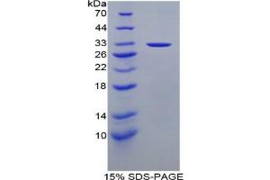 SDS-PAGE analysis of Mouse Stratifin Protein. (14-3-3 sigma/SFN 蛋白)