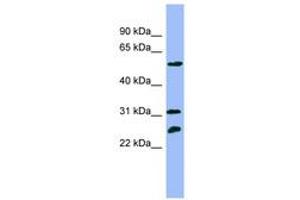 Image no. 1 for anti-Proteasome (Prosome, Macropain) 26S Subunit, ATPase, 4 (PSMC4) (N-Term) antibody (ABIN6741893) (PSMC4 抗体  (N-Term))