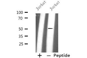 Western blot analysis of extracts from Jurkat cells, using PLD4 antibody. (Phospholipase D4 抗体  (C-Term))