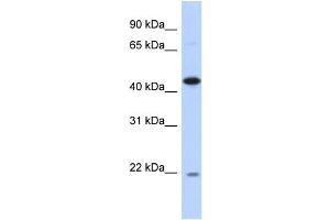 WB Suggested Anti-NOB1 Antibody Titration: 0.