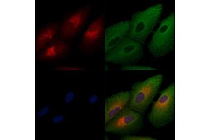 ABIN6257141 and ABIN6274489 staining  cells by IF/ICC. (DUSP9 抗体  (Internal Region))