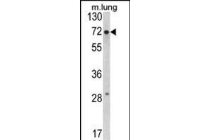 Western blot analysis of FMR1 Antibody (N-term) (ABIN390866 and ABIN2841083) in mouse lung tissue lysates (35 μg/lane).
