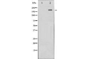 Western Blotting (WB) image for anti-Insulin Receptor Substrate 1 (IRS1) (pSer307) antibody (ABIN1844090) (IRS1 抗体  (pSer307))