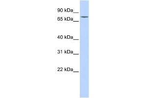 WB Suggested Anti-GALC Antibody Titration:  0. (GALC 抗体  (Middle Region))