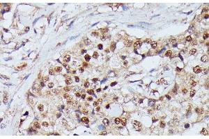 Immunohistochemistry (Paraffin-embedded Sections) (IHC (p)) image for anti-Immunoglobulin mu Binding Protein 2 (IGHMBP2) antibody (ABIN7258876)