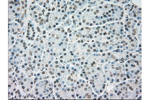 Immunohistochemical staining of paraffin-embedded colon tissue using anti-BRAFmouse monoclonal antibody. (BRAF 抗体)