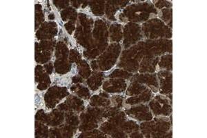 Immunohistochemical staining of human stomach with ABHD2 polyclonal antibody  shows strong cytoplasmic positivity in glandular cells at 1:10-1:20 dilution. (ABHD2 抗体)