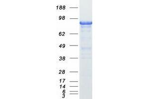 Western Blotting (WB) image for Breast Cancer Anti-Estrogen Resistance 1 (BCAR1) protein (Myc-DYKDDDDK Tag) (ABIN2715175)