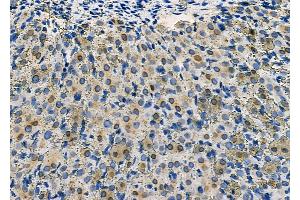 ABIN6264633 and ABIN6277558 at 1/100 staining Rat ovarian tissue by IHC-P.