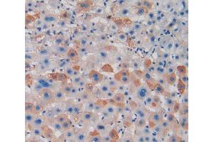 IHC-P analysis of liver tissue, with DAB staining. (PAD4 抗体  (AA 1-300))