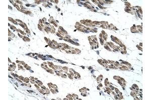 RNF40 antibody was used for immunohistochemistry at a concentration of 4-8 ug/ml to stain Skeletal muscle cells (arrows) in Human Muscle. (RNF40 抗体  (C-Term))