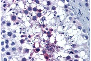 Human Testis: Formalin-Fixed, Paraffin-Embedded (FFPE) (ERP44 抗体  (AA 30-407))