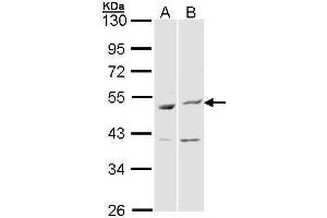 WB Image Sample (30 ug of whole cell lysate) A: Hela B: Molt-4 , 10% SDS PAGE antibody diluted at 1:1000 (BAG5 抗体)