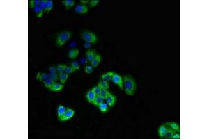 Immunofluorescent analysis of PC-3 cells using ABIN7172188 at dilution of 1:100 and Alexa Fluor 488-congugated AffiniPure Goat Anti-Rabbit IgG(H+L) (DIO3 抗体  (AA 50-115))