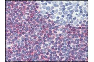 Immunohistochemistry (IHC) image for anti-Programmed Cell Death 4 (PDCD4) (AA 1-469), (N-Term) antibody (ABIN317548) (PDCD4 抗体  (N-Term))