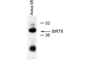 IP: 5 ul in 1ml of U2OS lysates (SIRT6 抗体  (Middle Region))