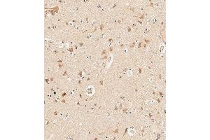 Immunohistochemical analysis of paraffin-embedded Human brain tissue using B performed on the Leica® BOND RXm.