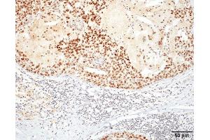 Immunohistochemistry analysis using Rat Anti-HSF1 Monoclonal Antibody, Clone 10H4 . (HSF1 抗体)