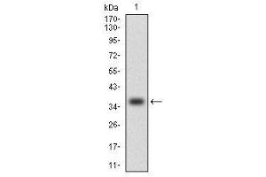 Image no. 4 for anti-Chemokine (C-C Motif) Ligand 2 (CCL2) antibody (ABIN1497128)