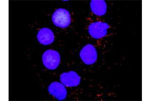 Proximity Ligation Analysis of protein-protein interactions between PXN and MAPK8. (JNK 抗体  (AA 1-384))
