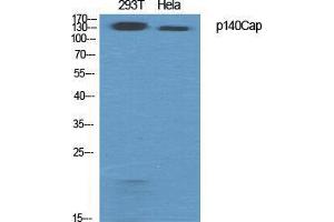Western Blot (WB) analysis of specific cells using p140Cap Polyclonal Antibody. (SRCIN1 抗体  (Internal Region))