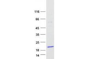 Western Blotting (WB) image for T-Cell Leukemia/lymphoma 1B (TCL1B) (Transcript Variant 1) protein (Myc-DYKDDDDK Tag) (ABIN2733368)