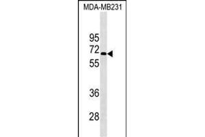 KCNF1 Antibody (Center) (ABIN1538031 and ABIN2849487) western blot analysis in MDA-M cell line lysates (35 μg/lane). (KCNF1 抗体  (AA 195-221))
