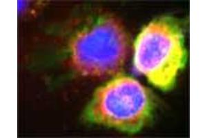 Confocal microscopy on isolated monocytes. (Myeloperoxidase 抗体)