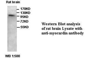 Image no. 1 for anti-Myocardin (MYOCD) antibody (ABIN791202) (Myocardin 抗体)