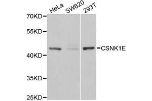 Western Blotting (WB) image for anti-Casein Kinase 1, epsilon (CSNK1E) antibody (ABIN1980191) (CK1 epsilon 抗体)