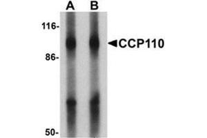 Western blot analysis of CCP110 in human colon tissue lysate with CCP110 Antibody  at (A) 1 and (B) 2 ug/mL. (Centriolin 抗体  (C-Term))