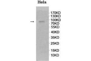Western blot analysis of fetal brain lysate using GnT-V Antibody at a dilution of 1/500. (MGAT5 抗体  (C-Term))