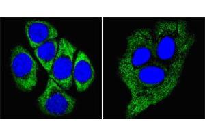 Confocal immunofluorescence analysis of methanol-fixed ECA109 cells (left) and HepG2 cells (right) using CK8 mouse mAb (green), showing cytoplasmic localization. (KRT8 抗体  (AA 391-483))